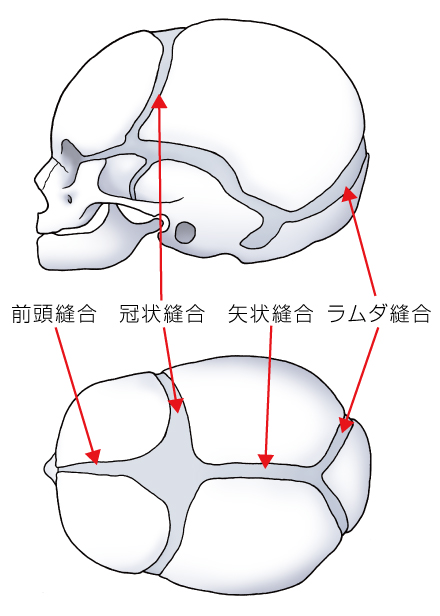 頭蓋骨縫合早期癒合症 一般社団法人 日本頭蓋顎顔面外科学会